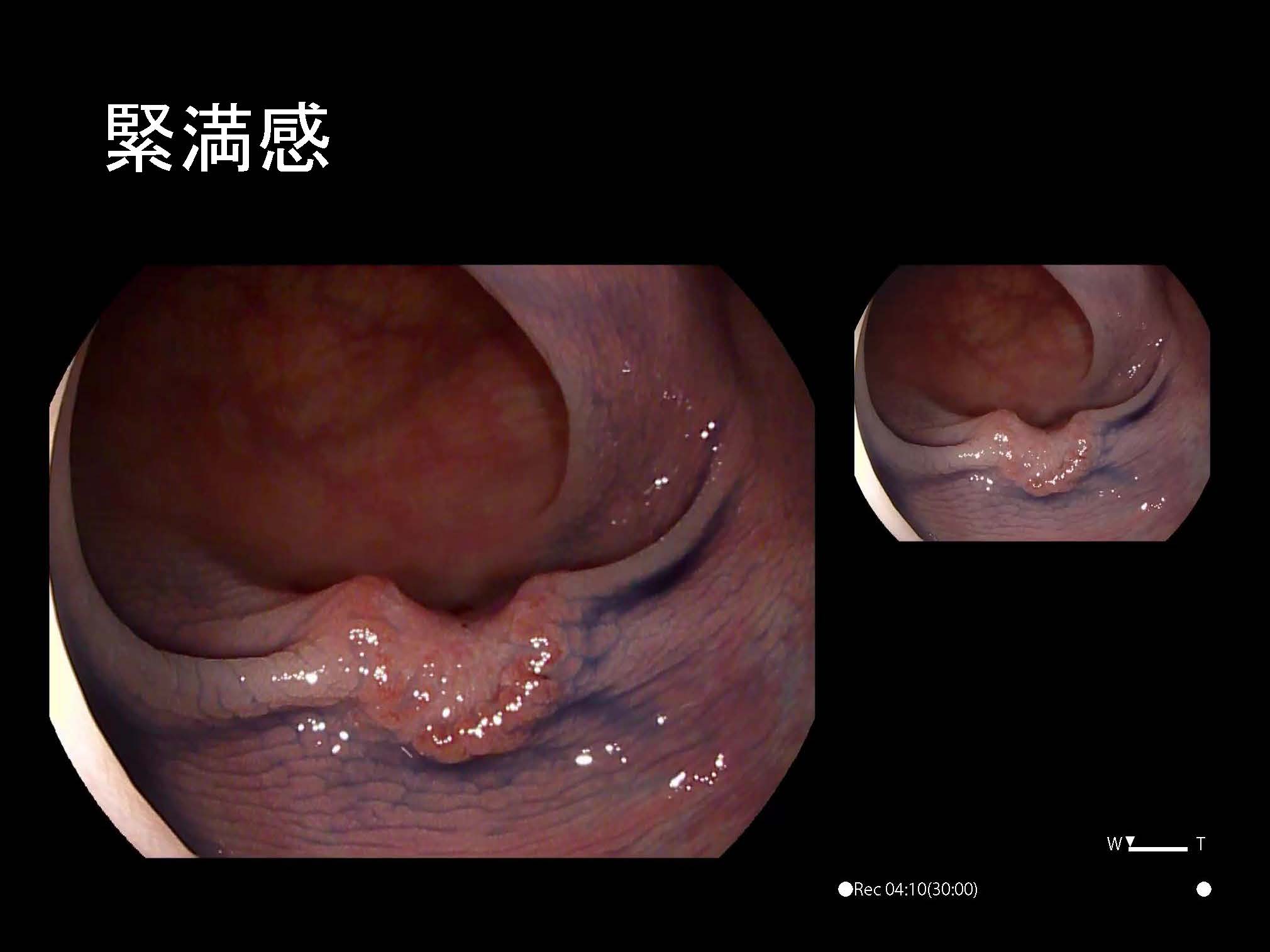 大腸090