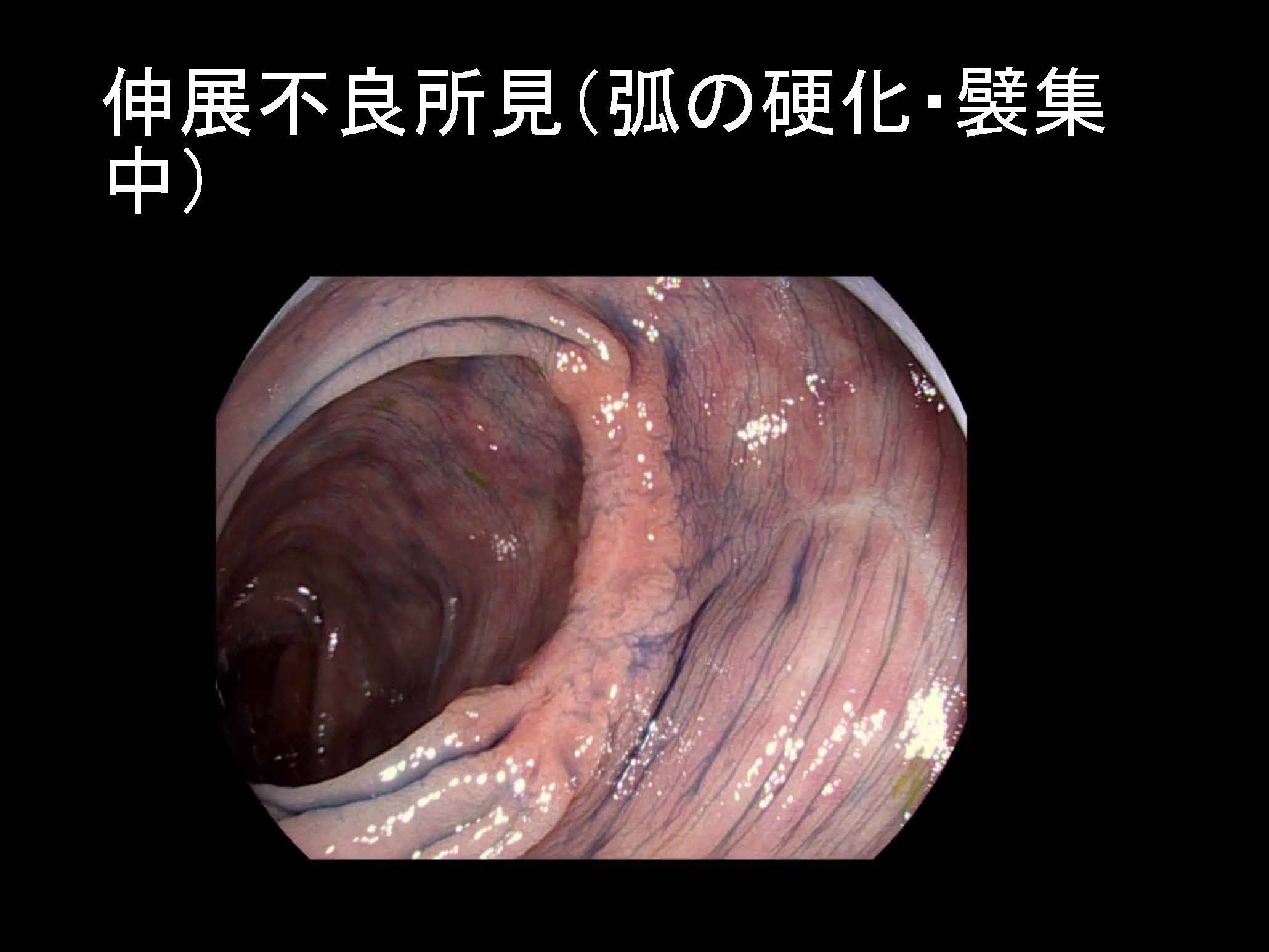 大腸094