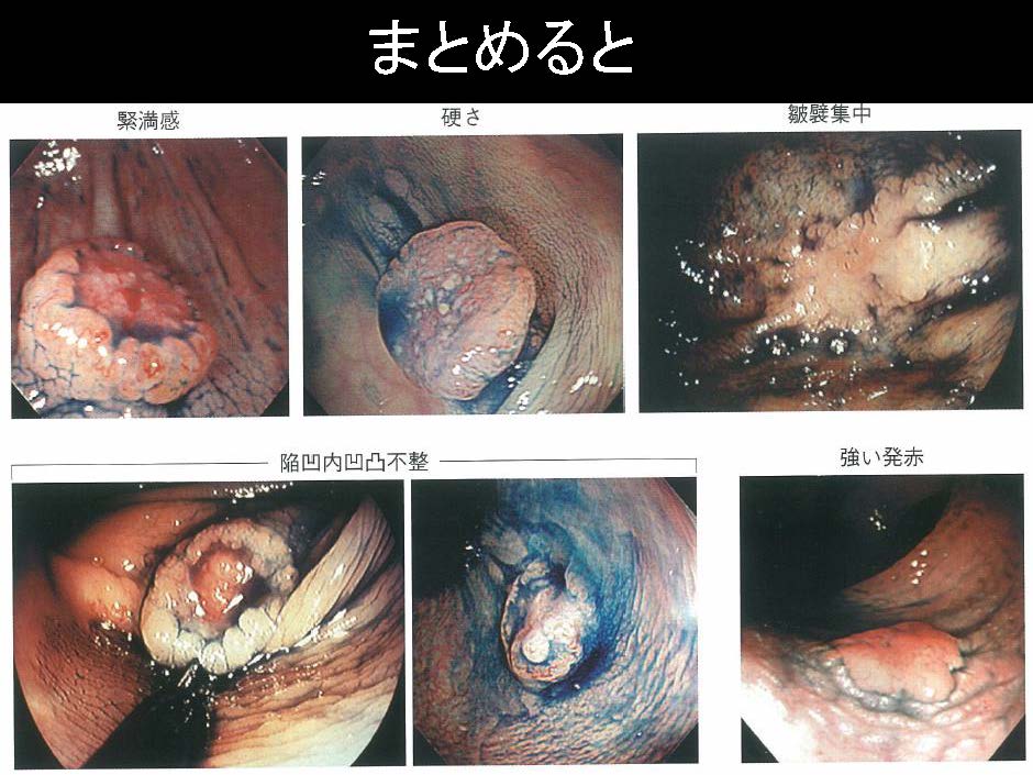 大腸095