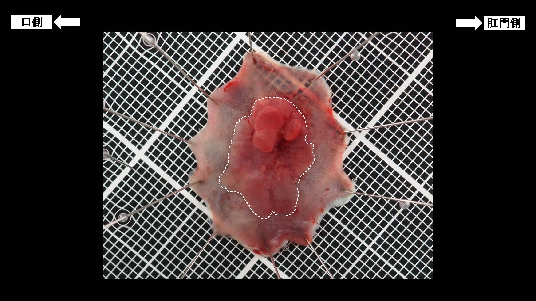 大腸024