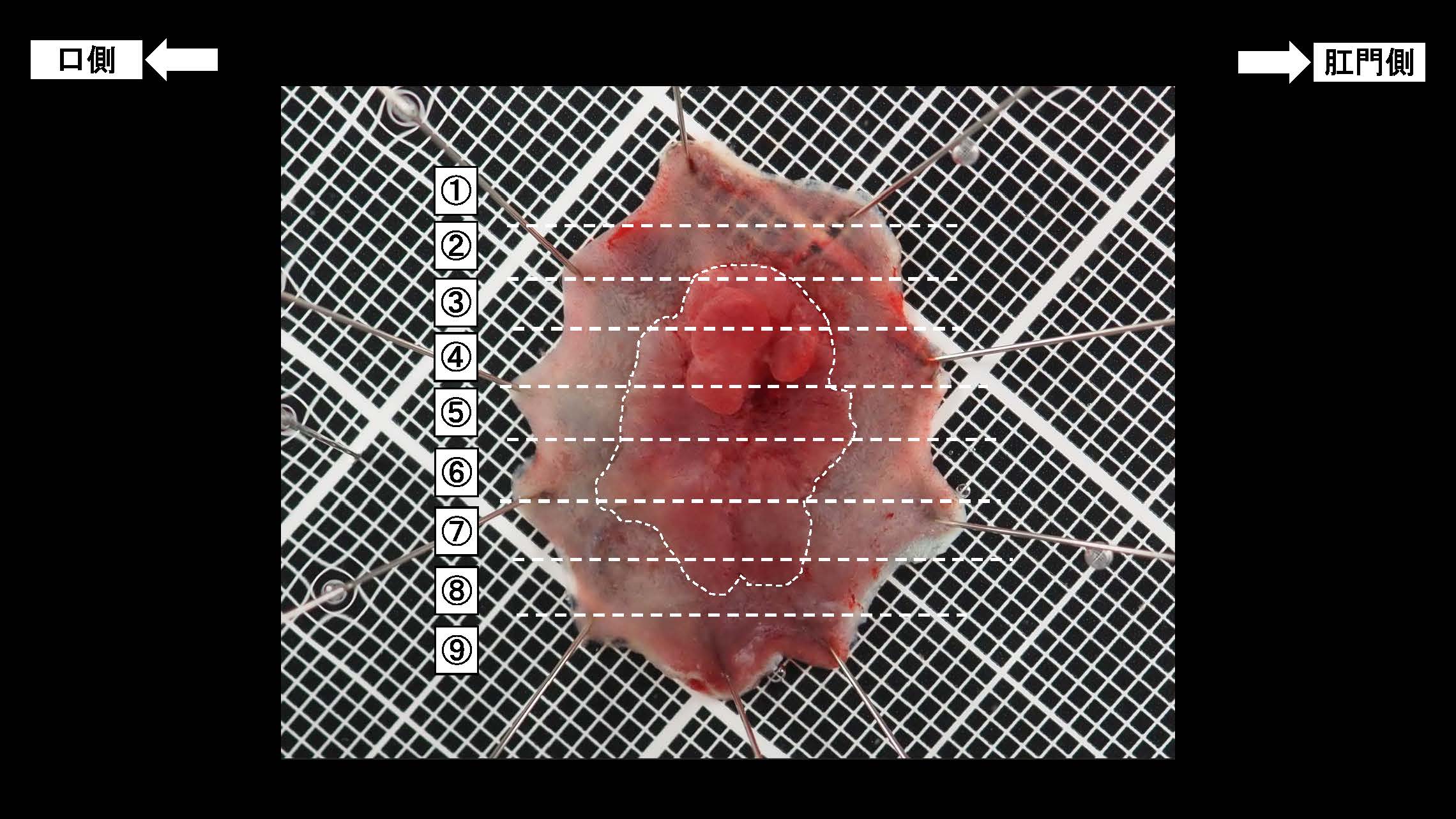 大腸031
