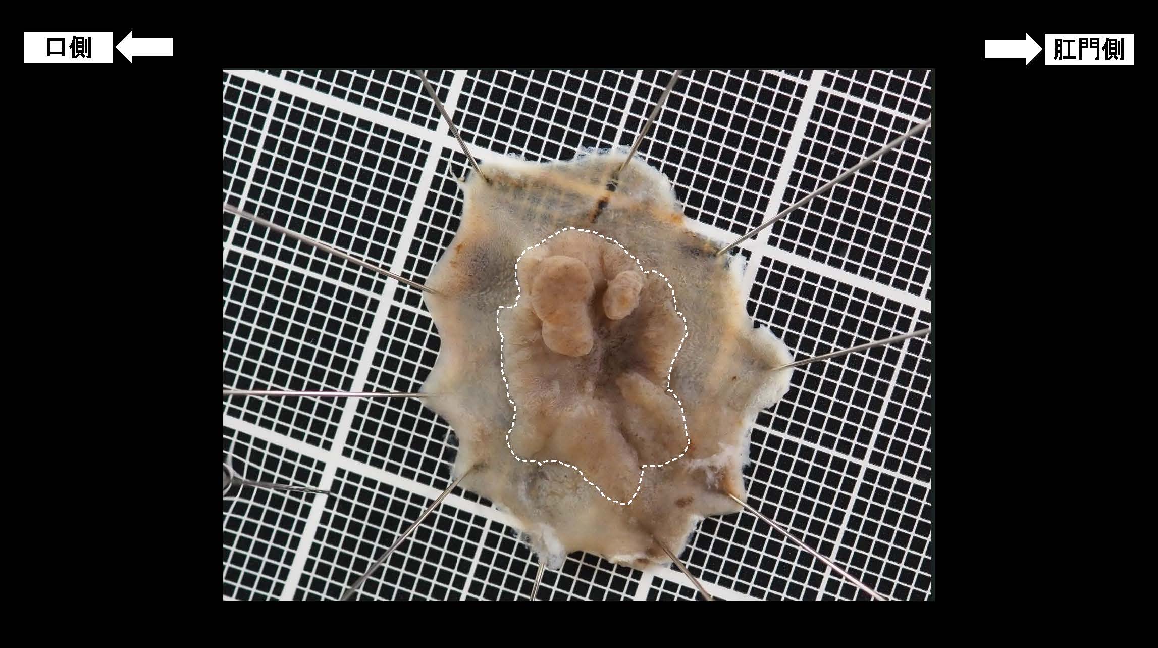 大腸033