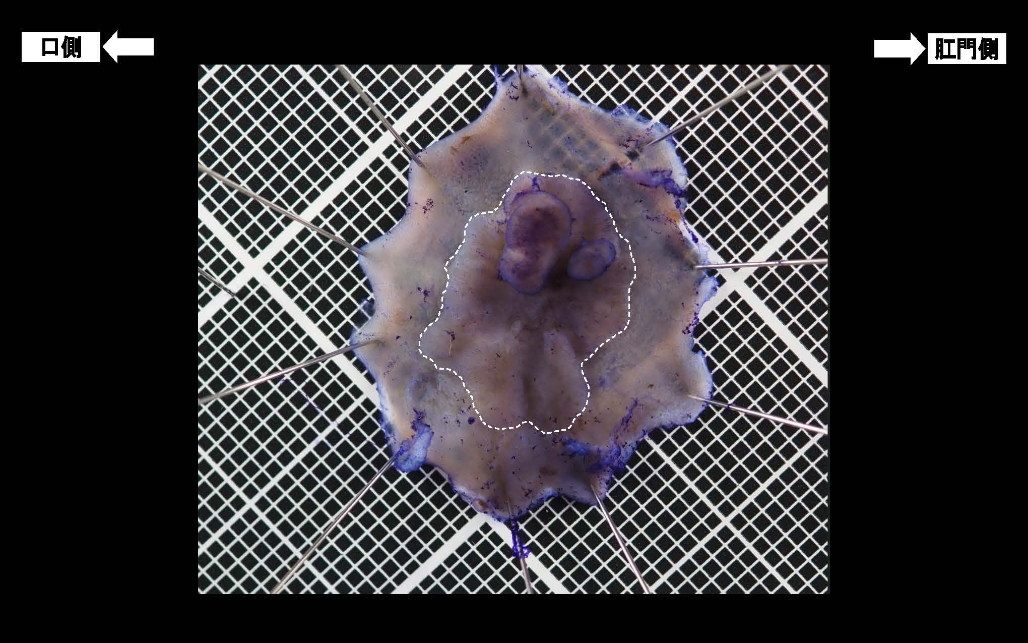 大腸036