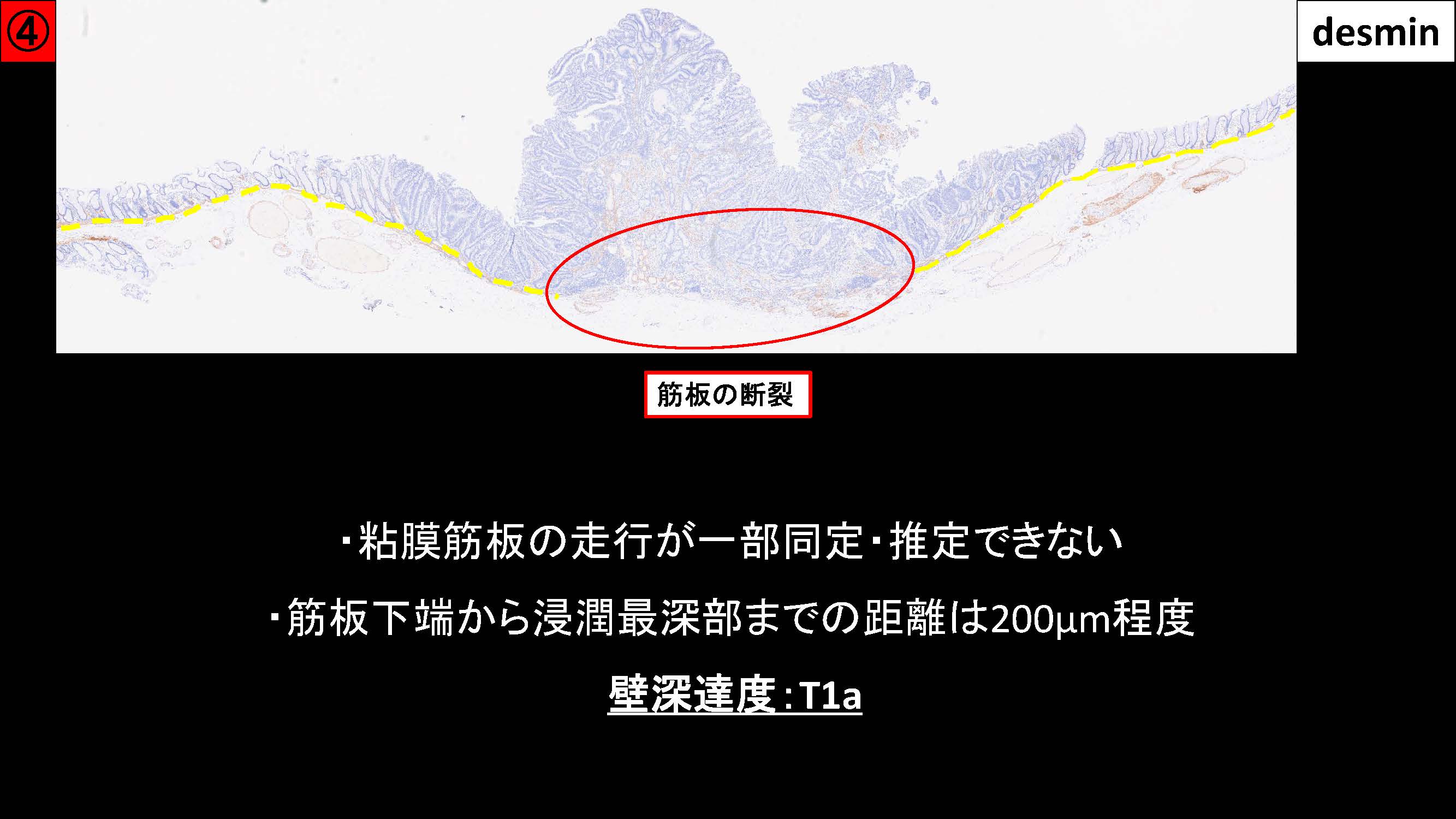 大腸051