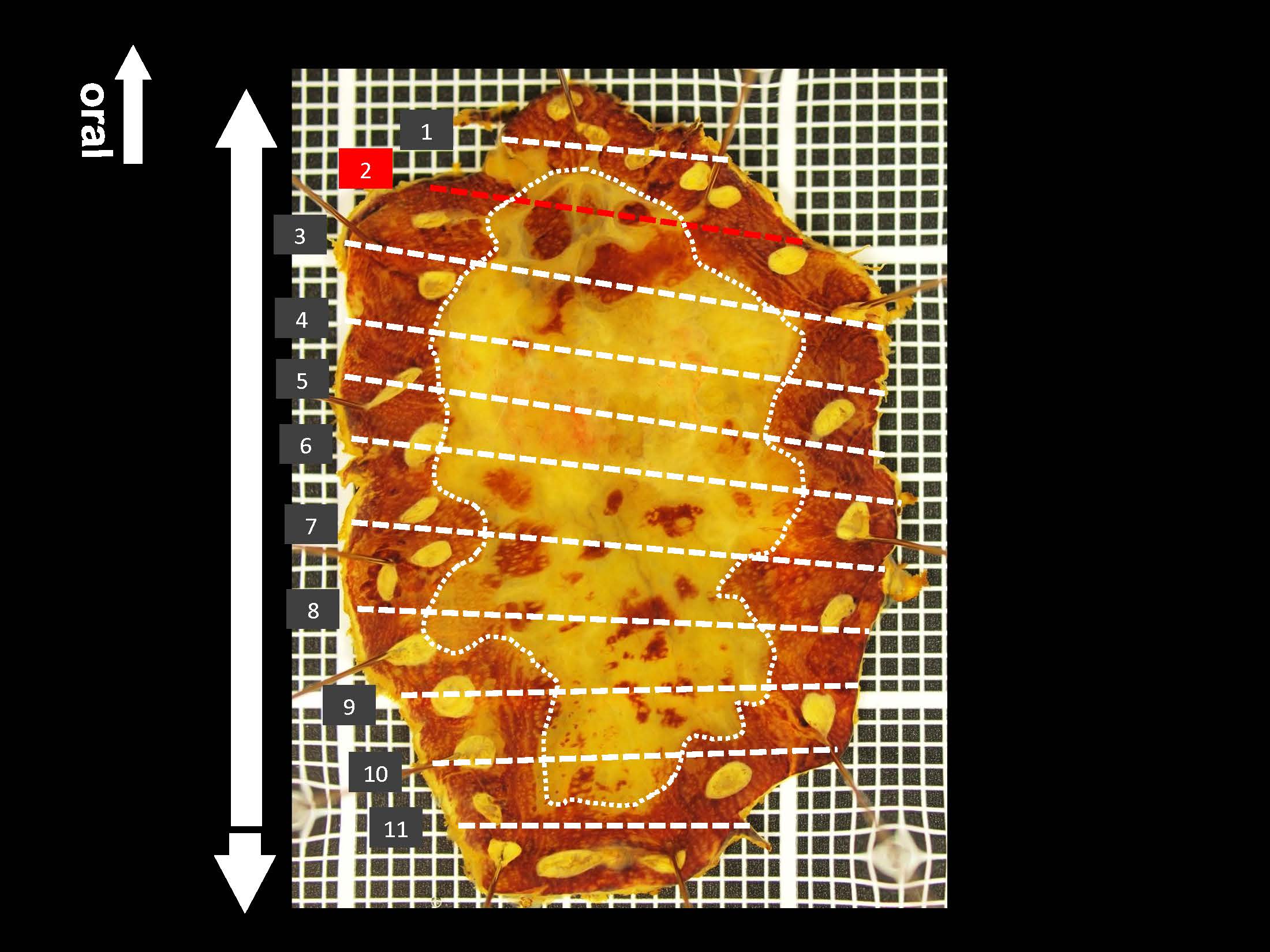 食道038
