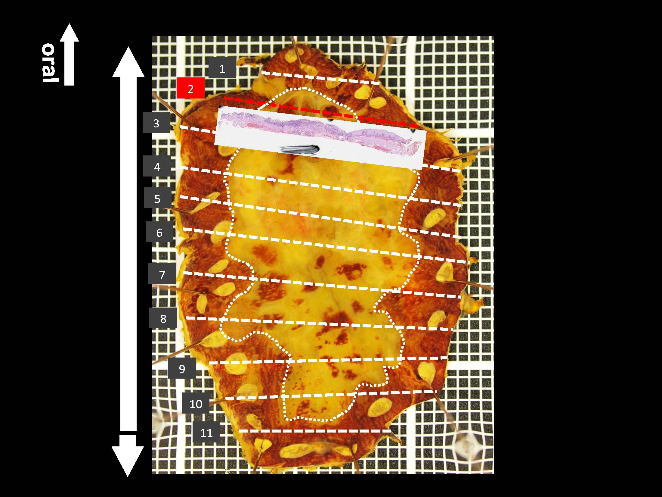 食道039