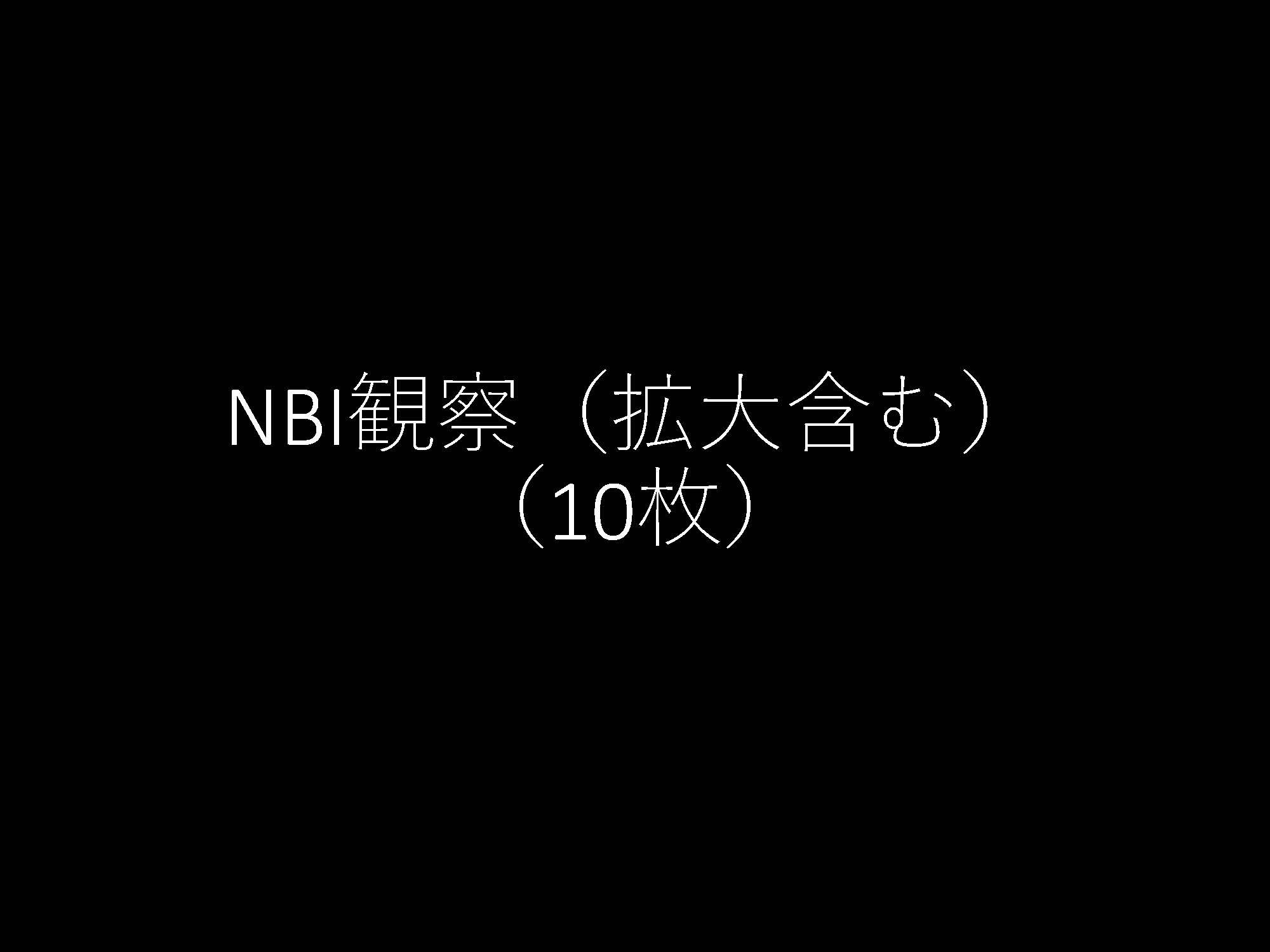胃011