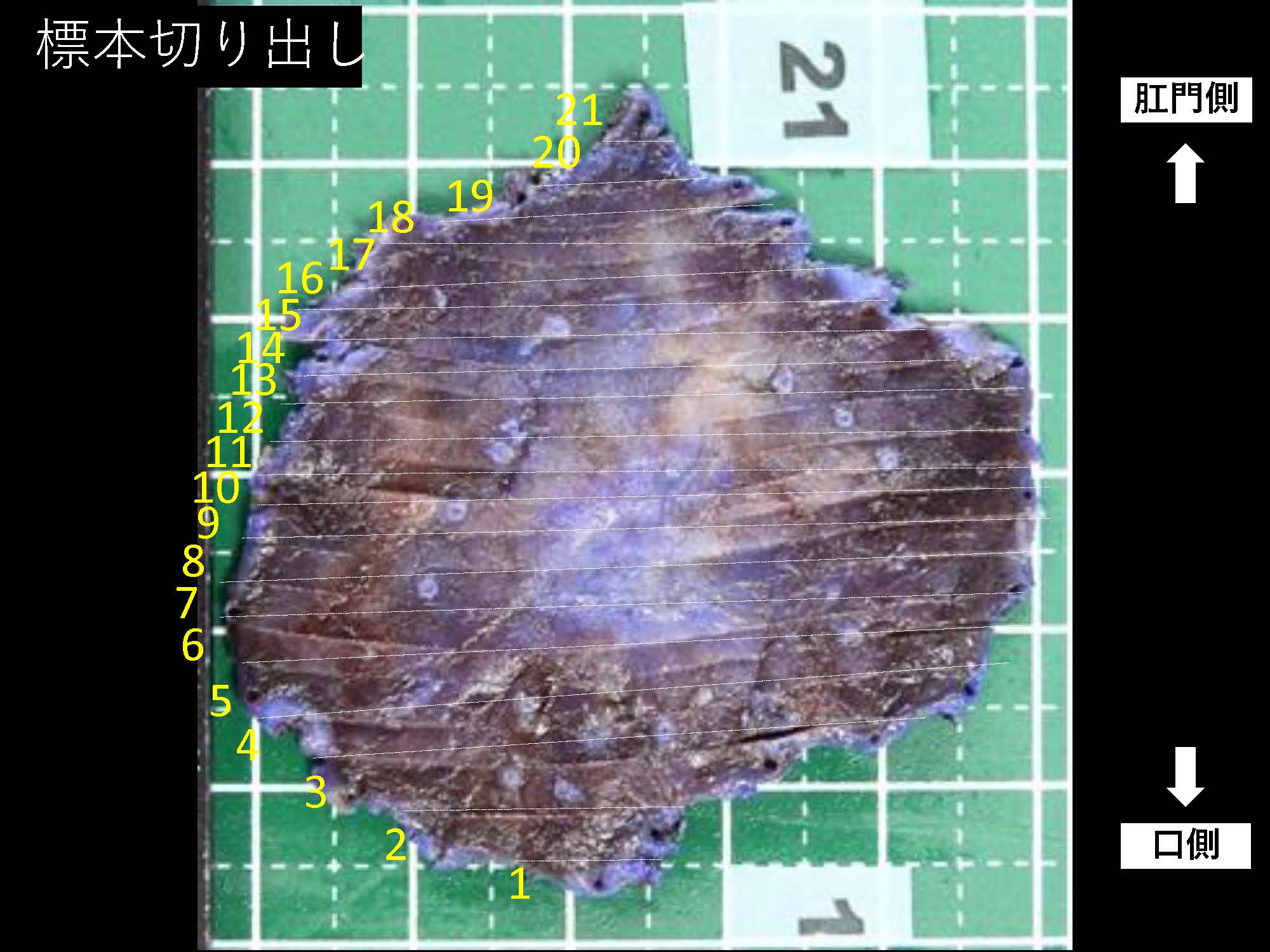 胃033