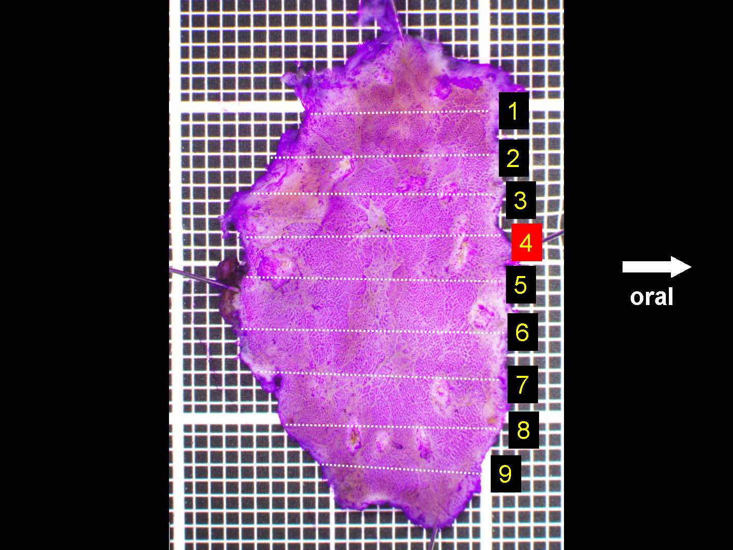 胃037