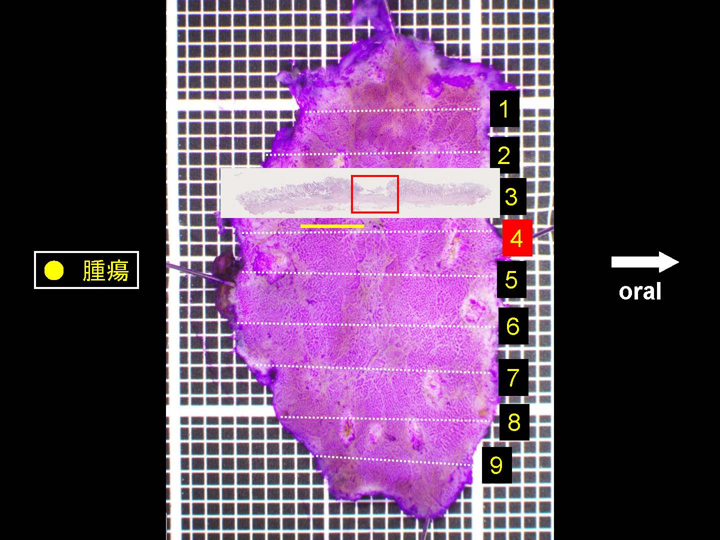 胃043