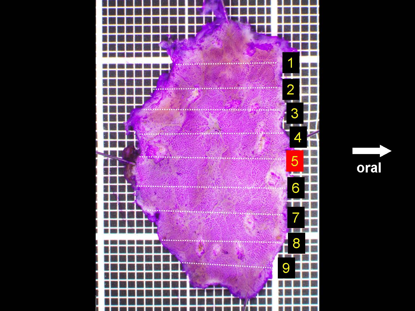 胃045