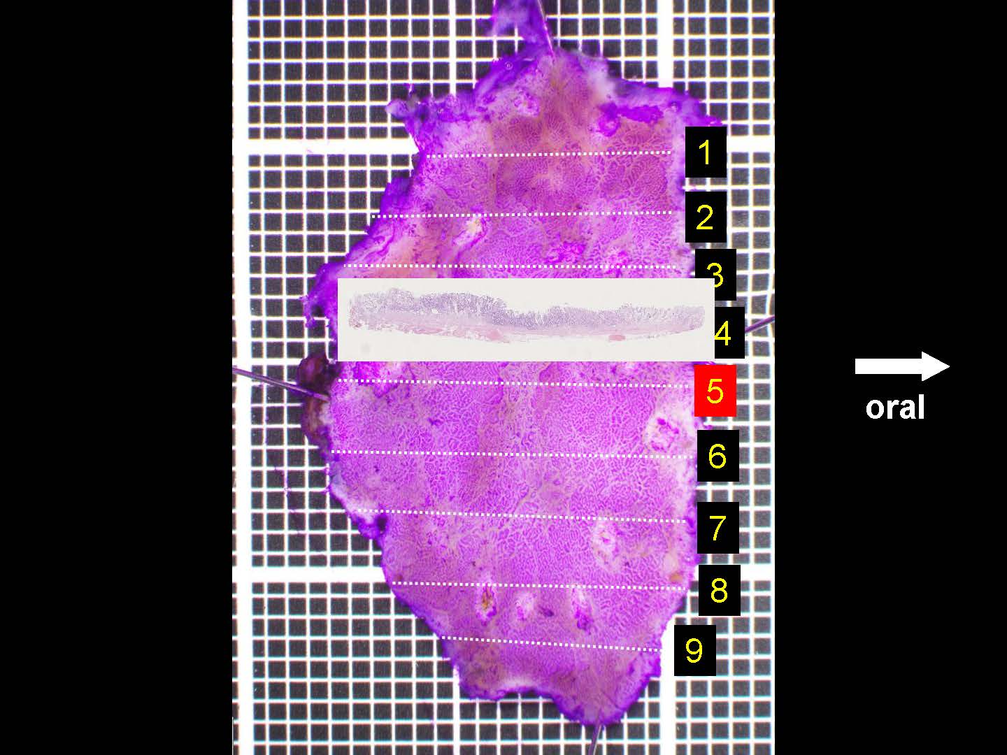 胃046