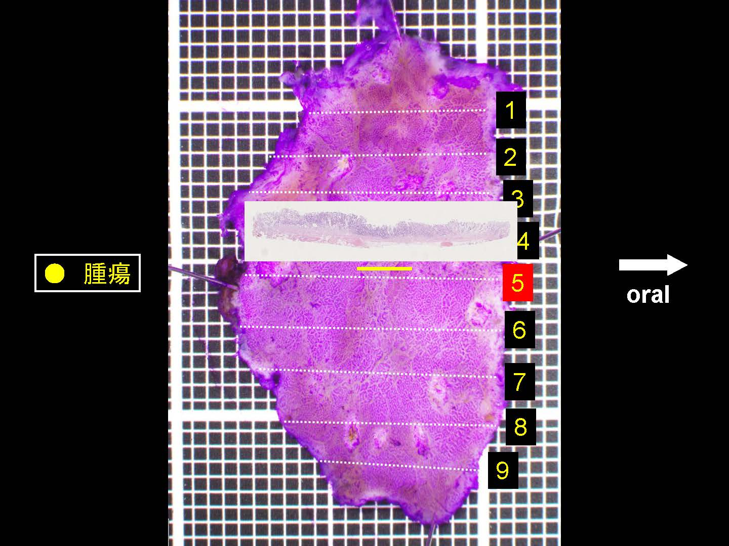 胃047