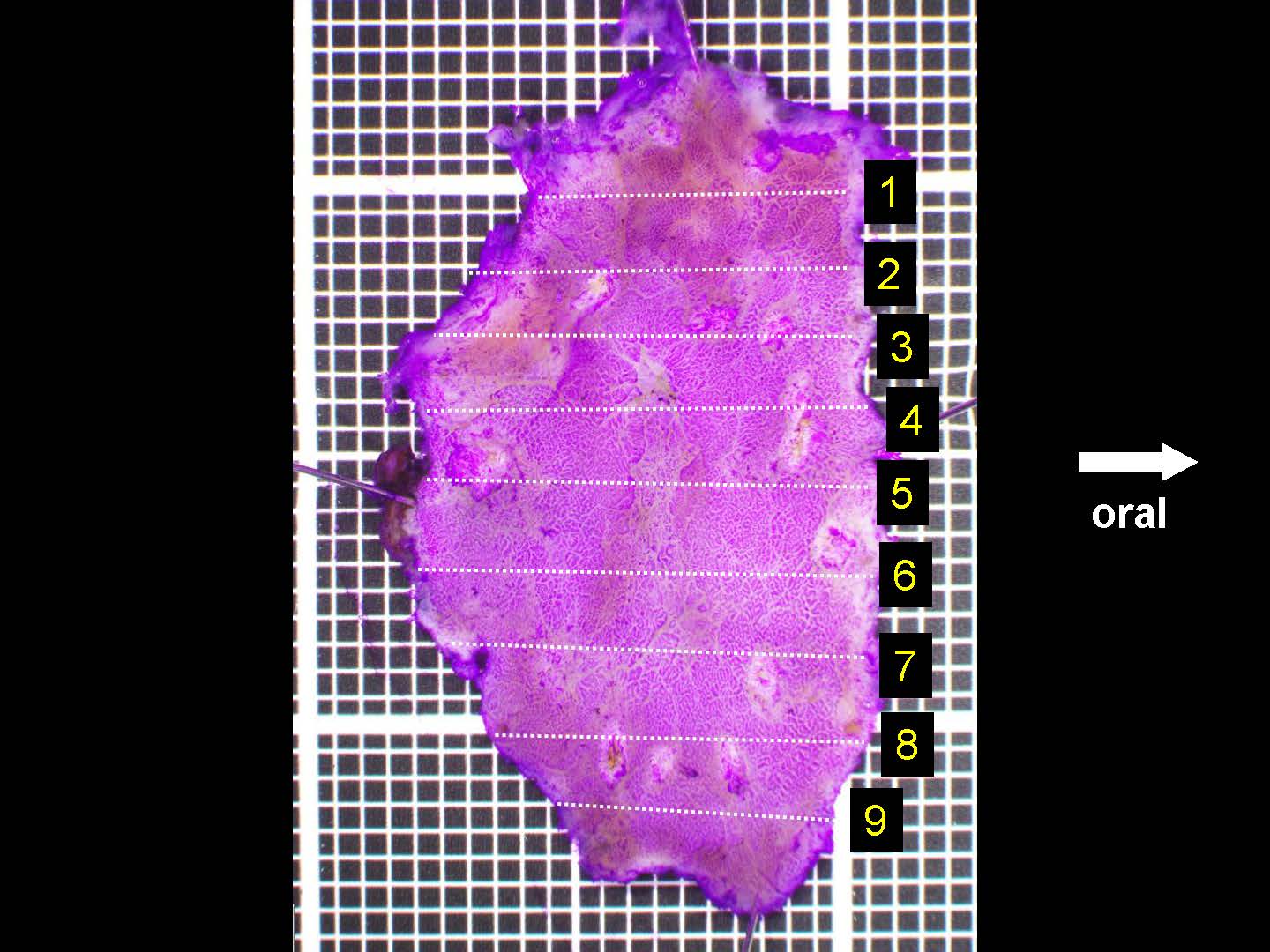 胃050