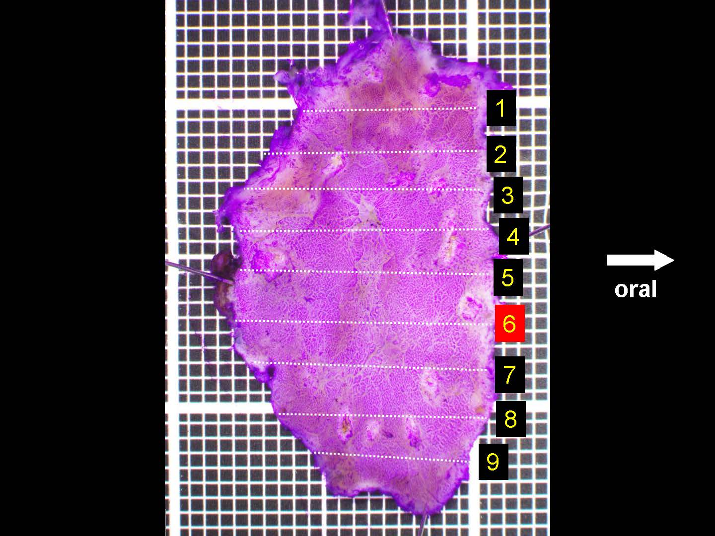 胃051