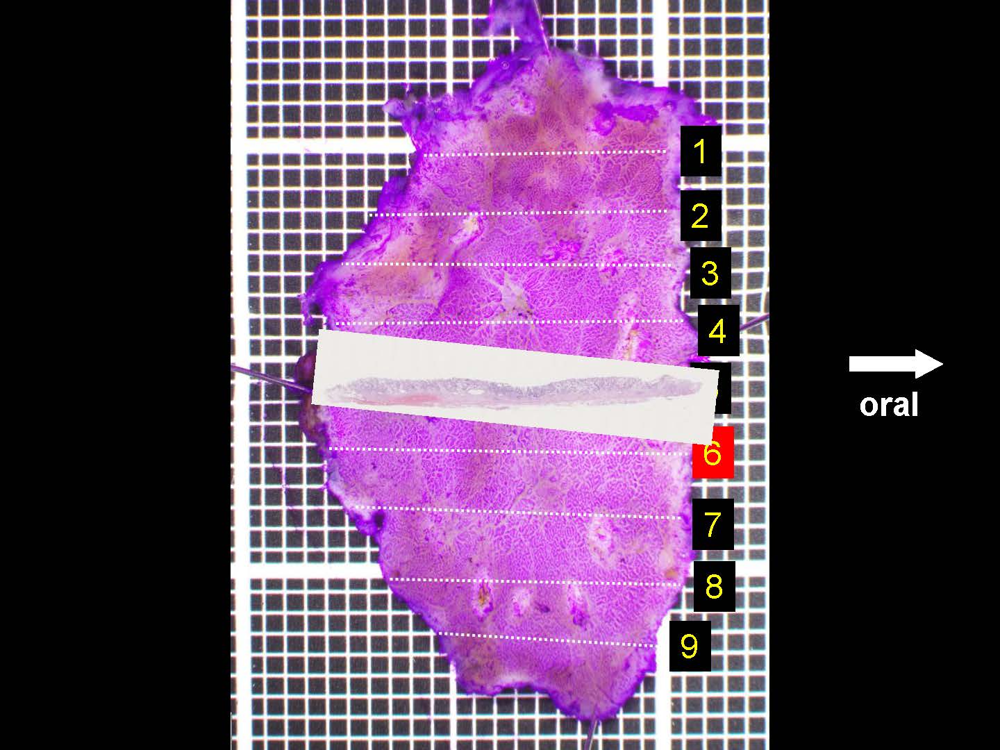 胃052