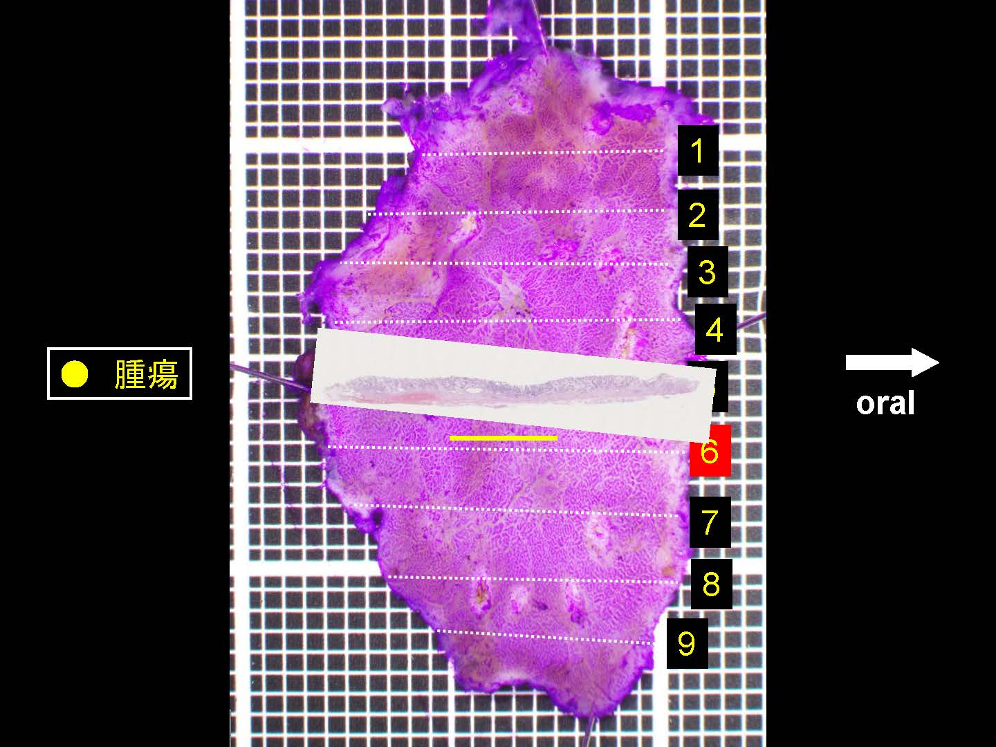 胃053