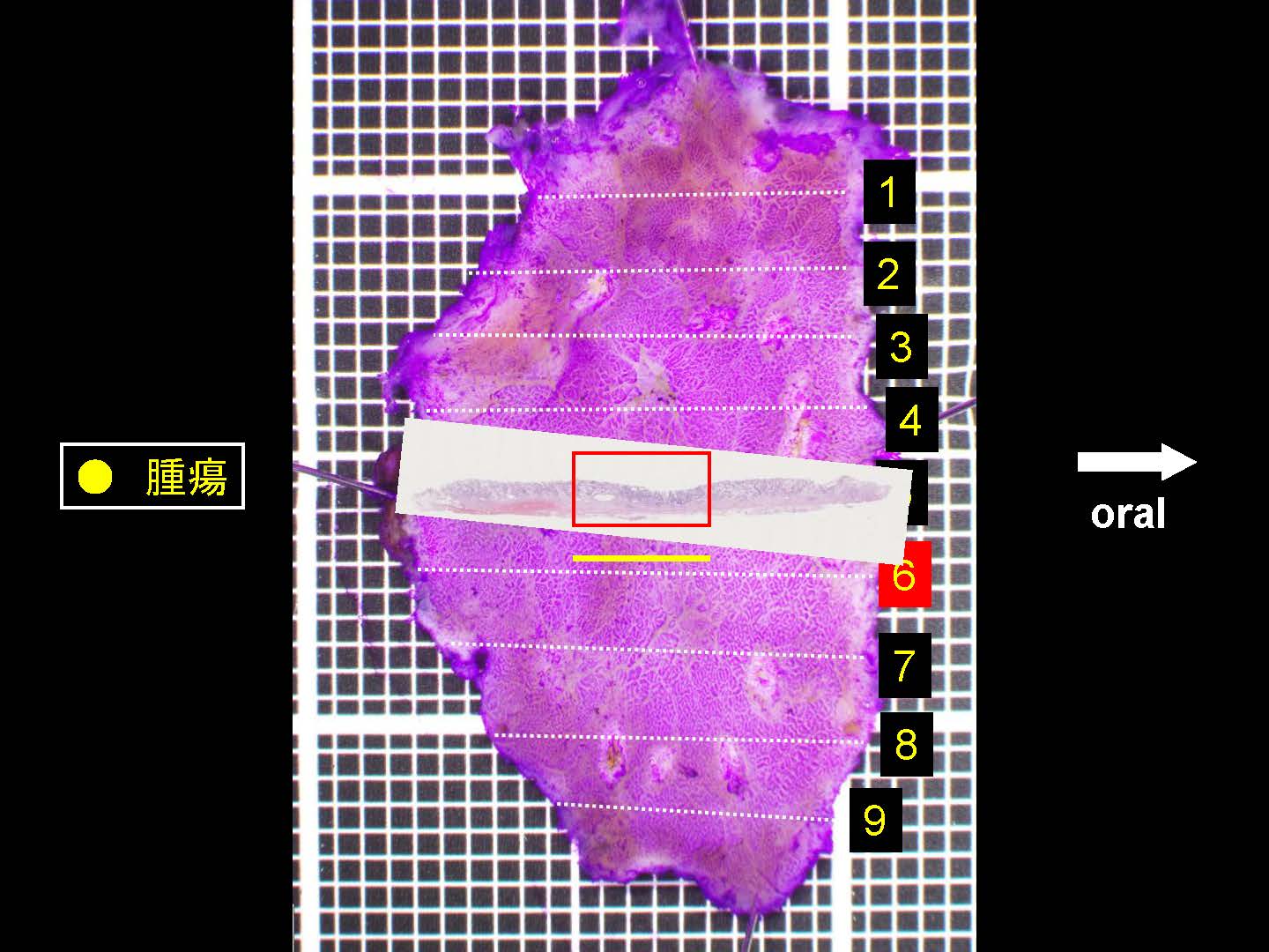 胃054