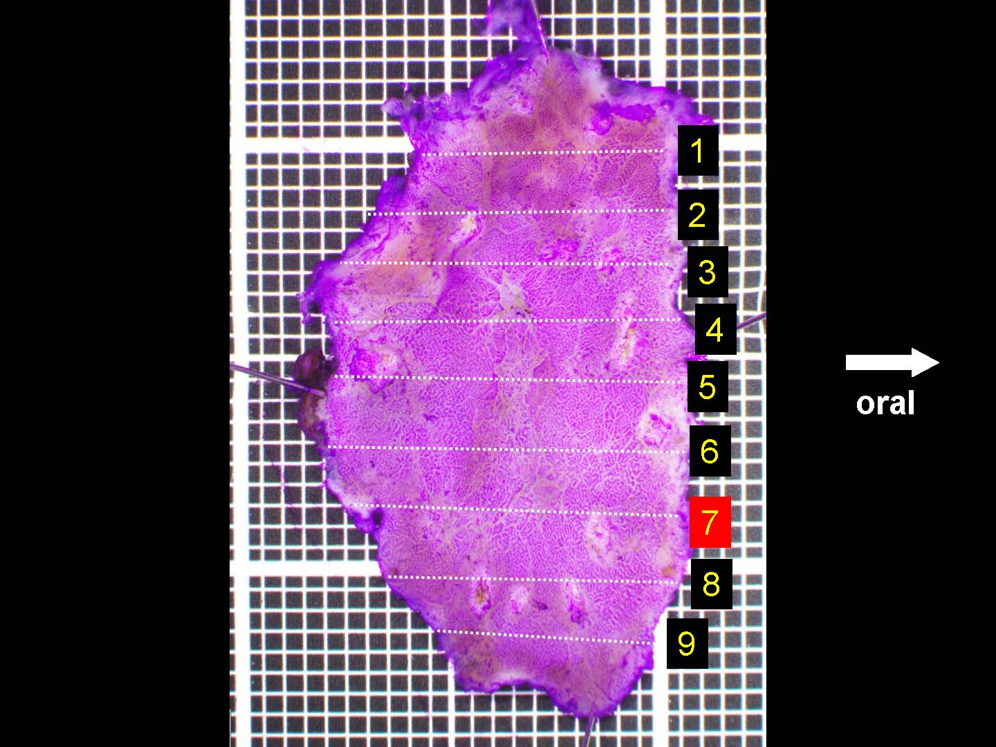 胃057
