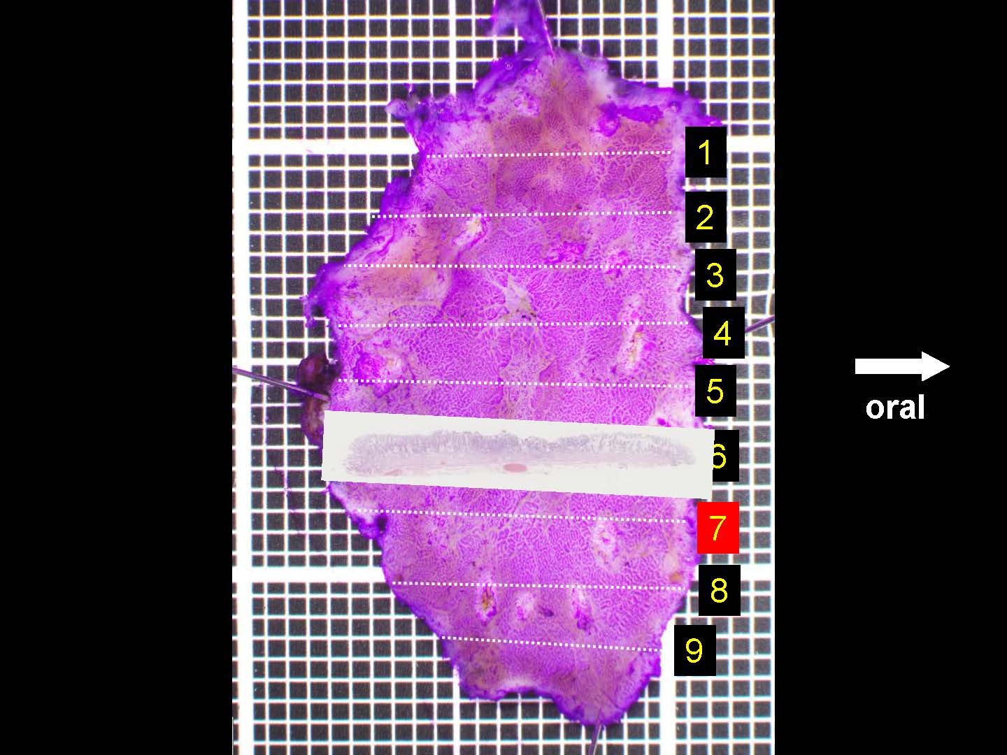 胃058