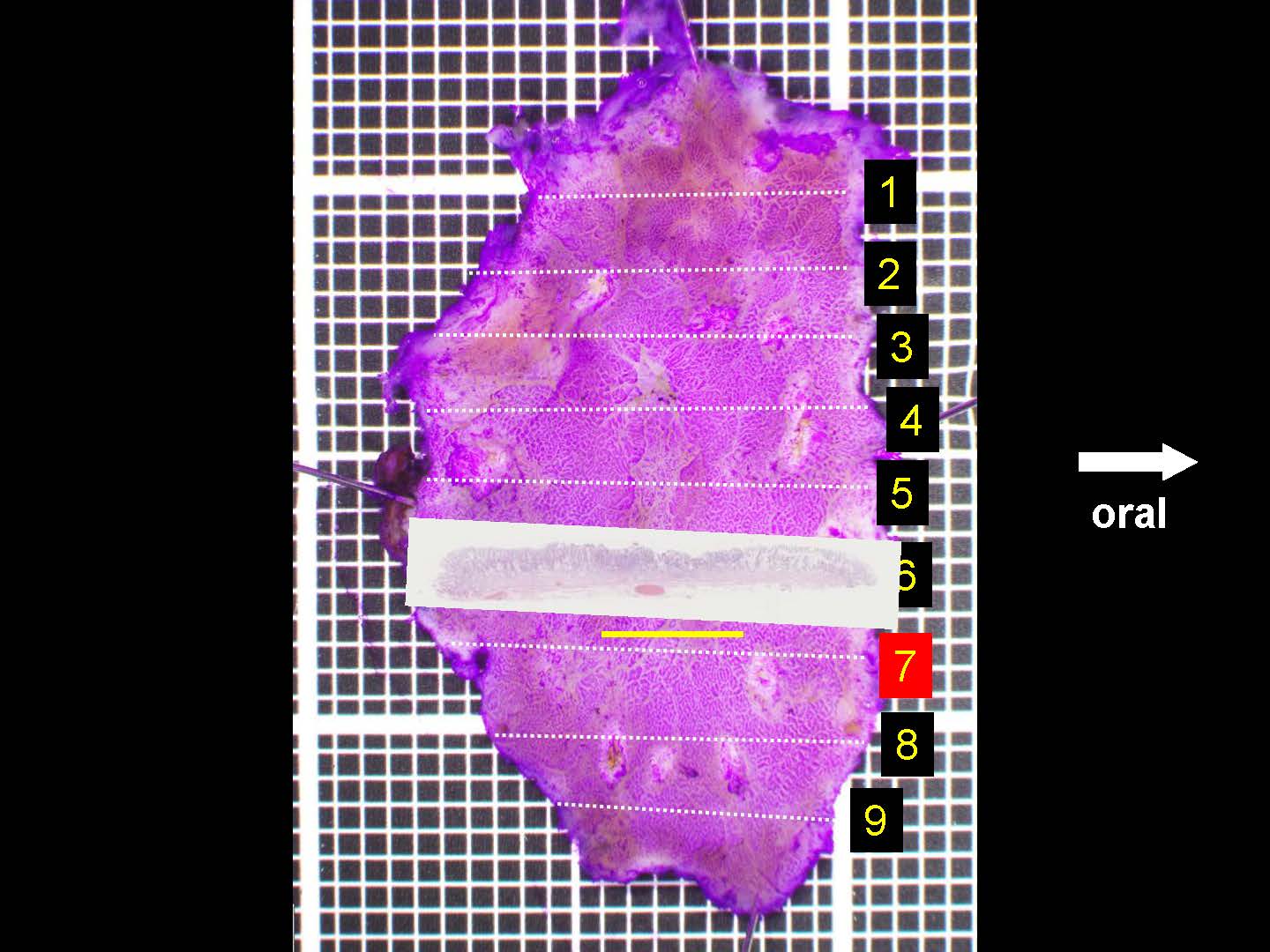 胃059
