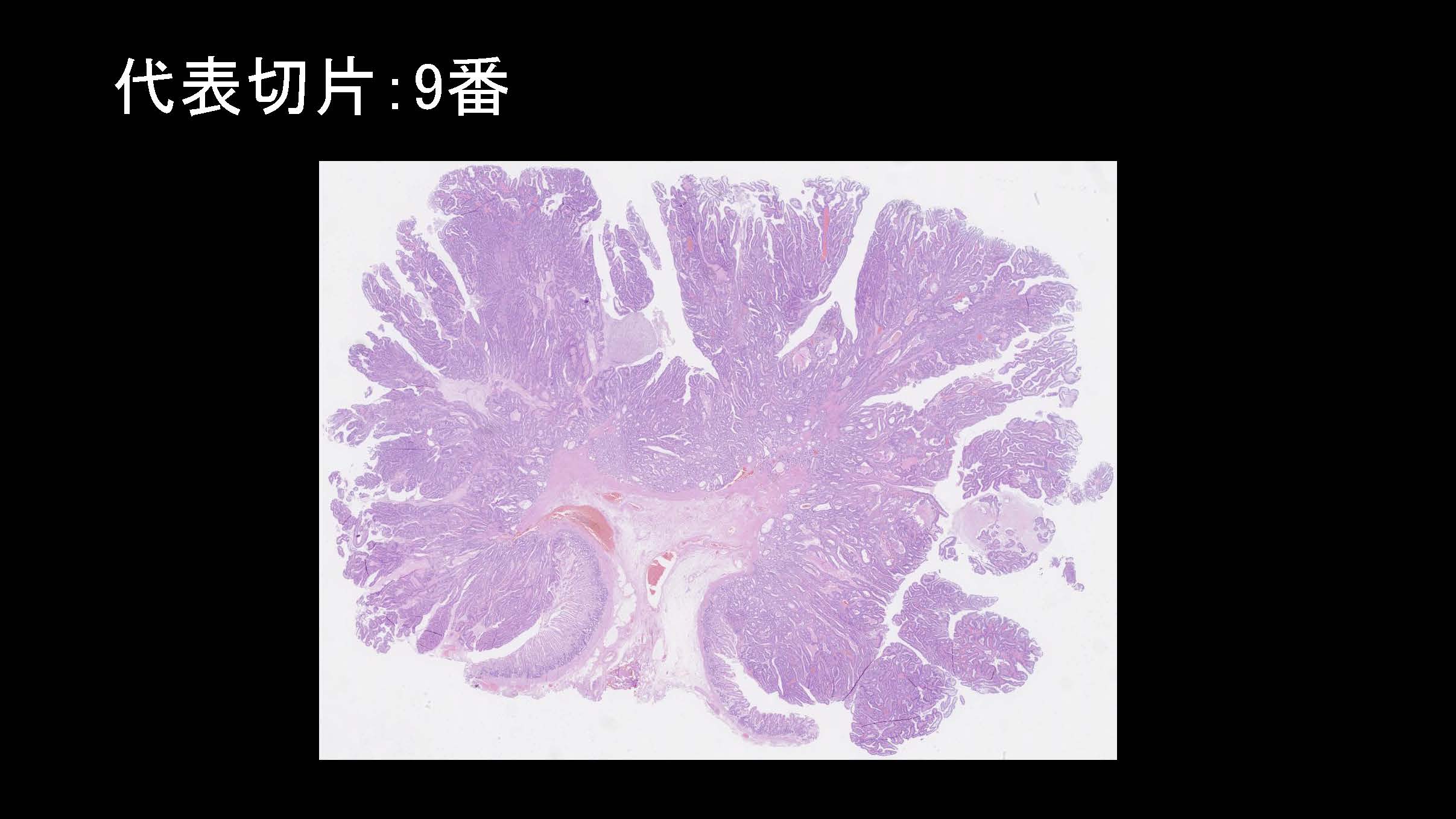 胃033