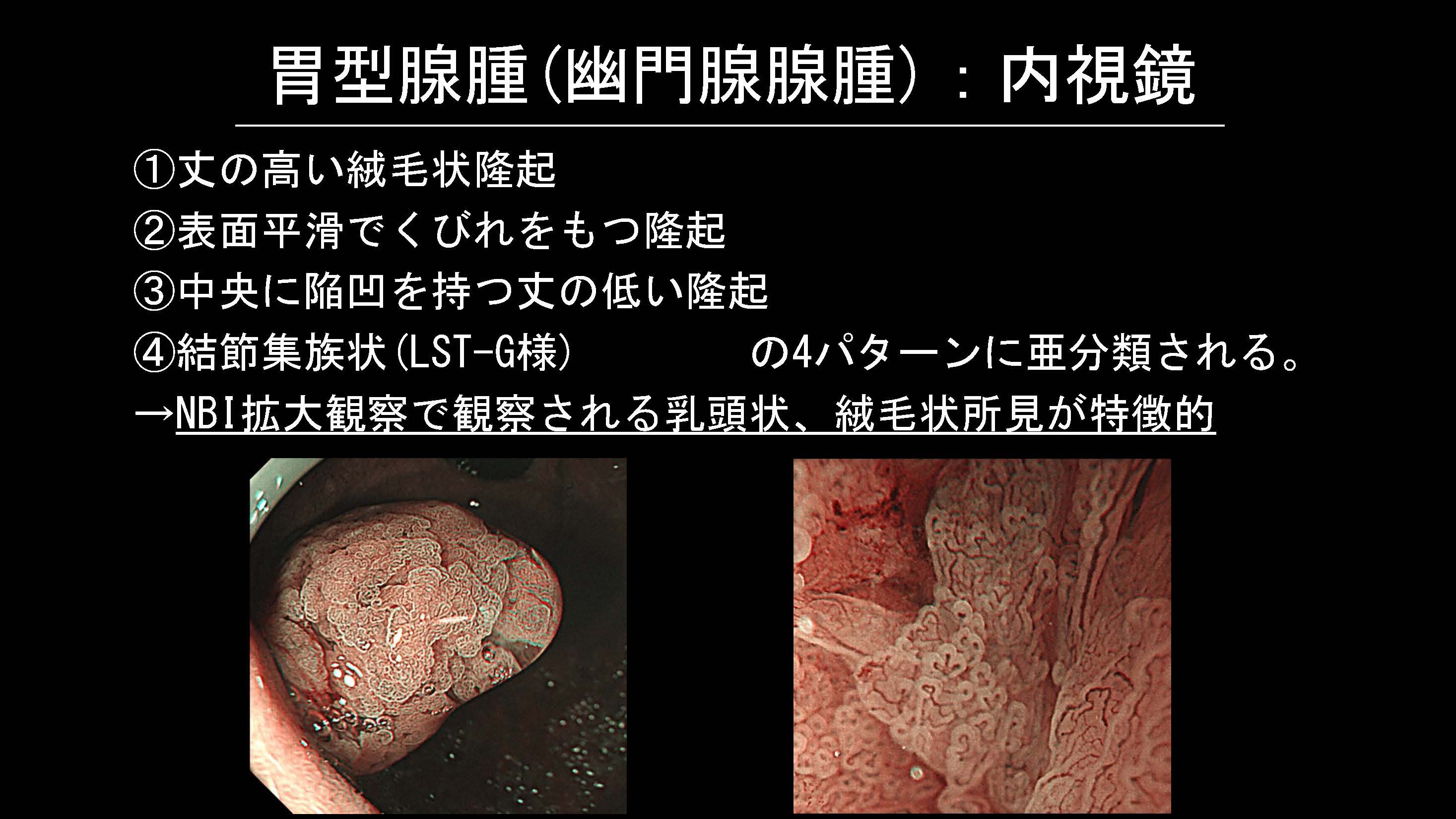 胃044