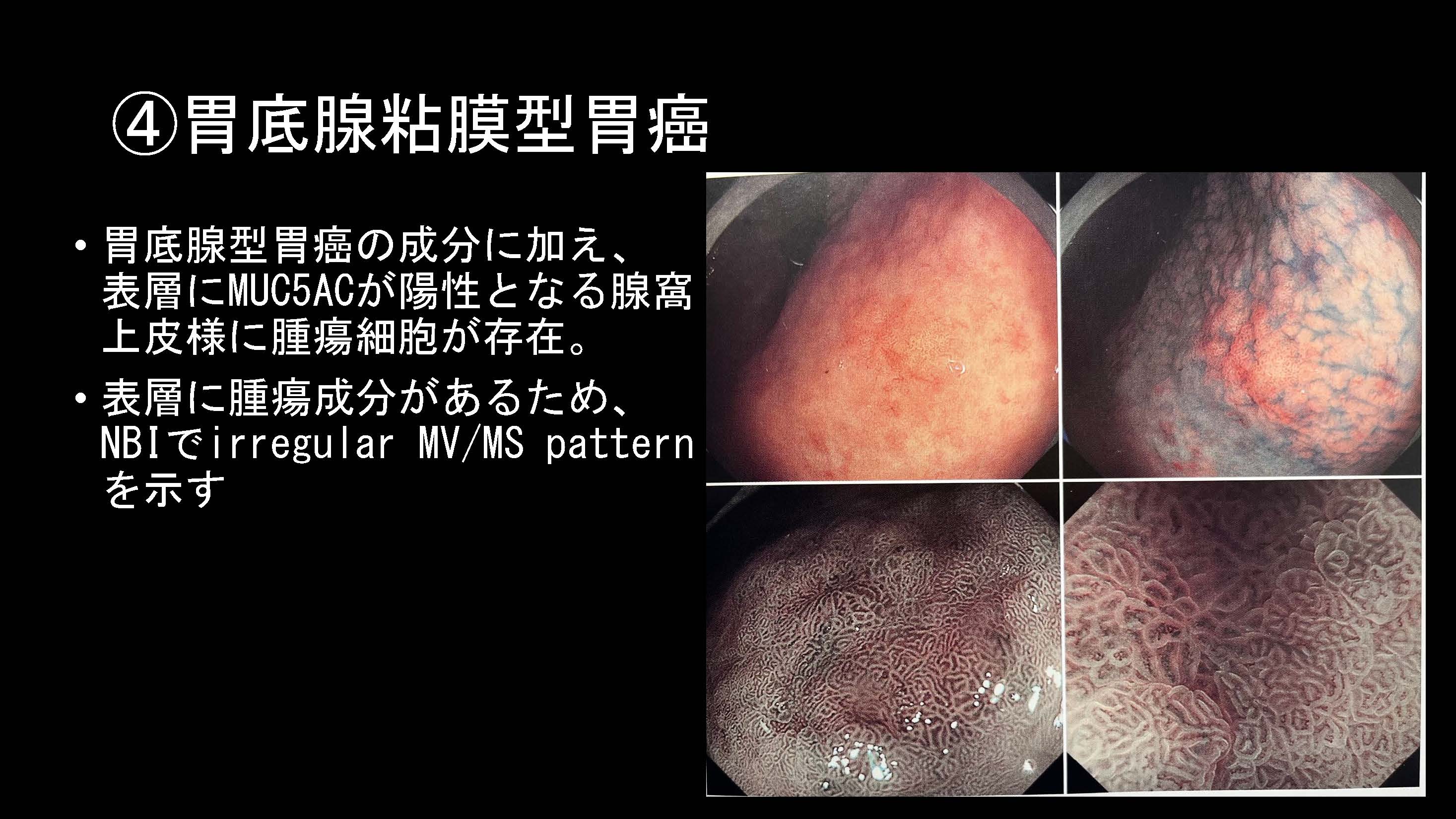 胃049