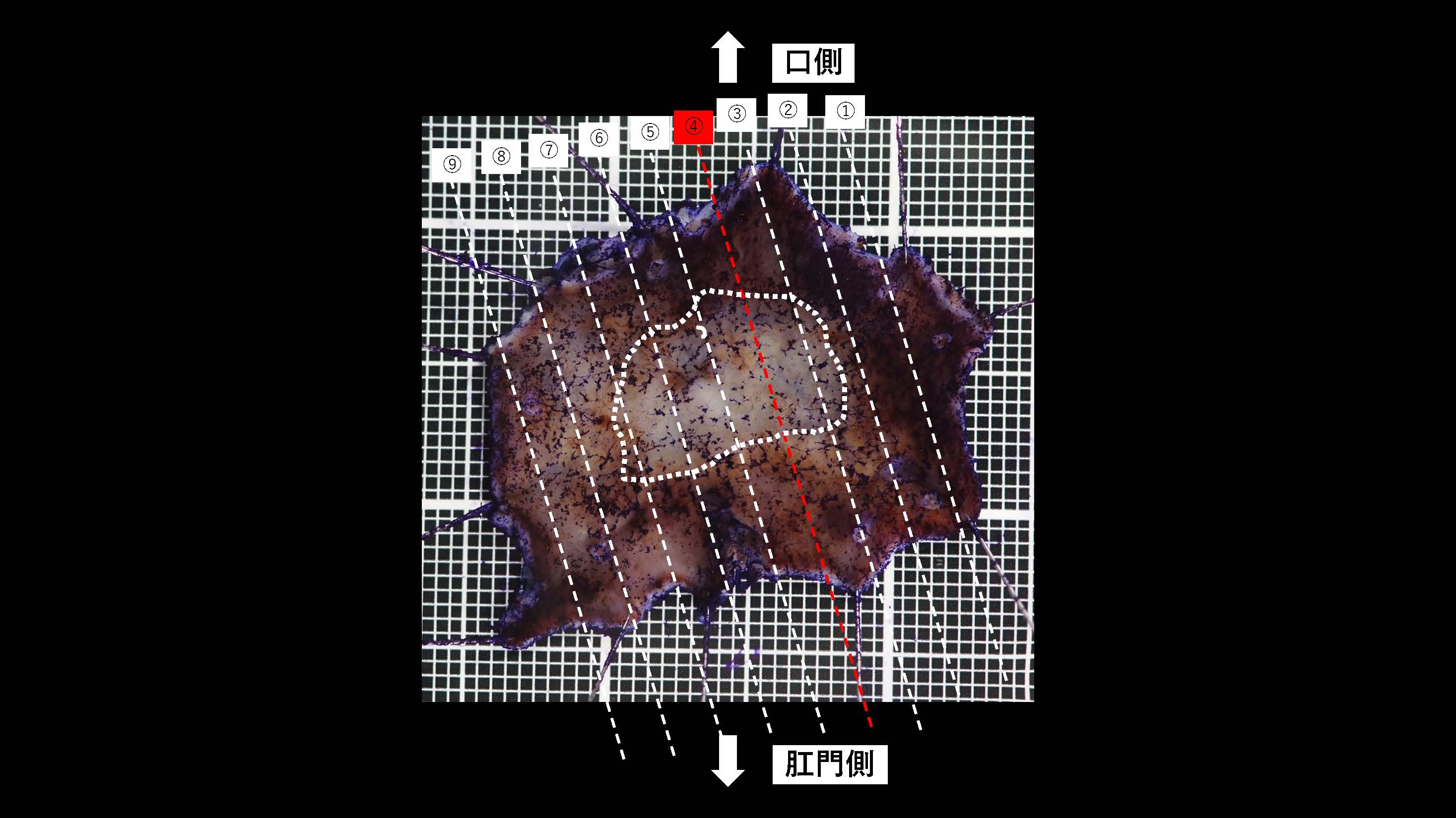 胃032