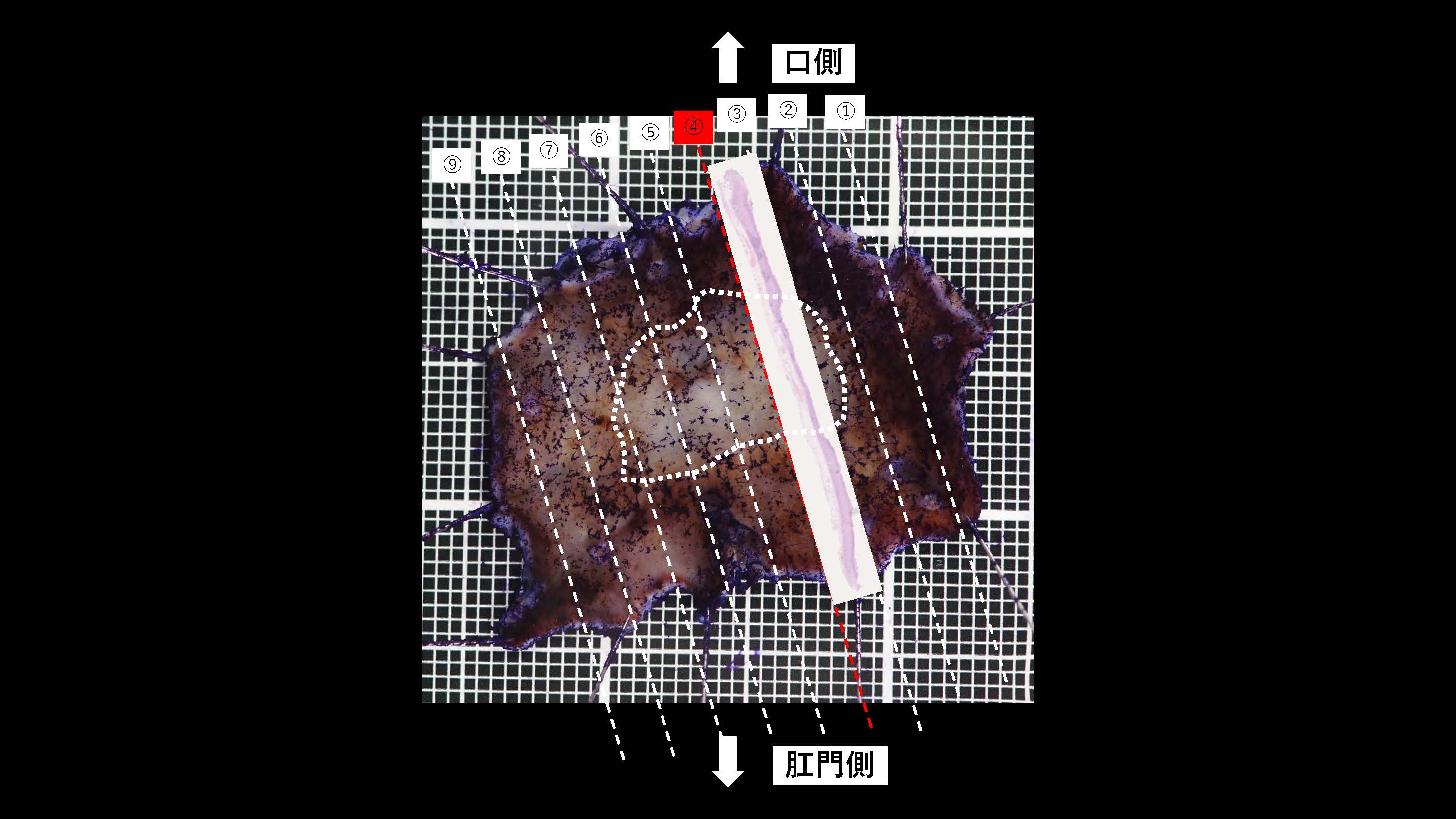 胃033