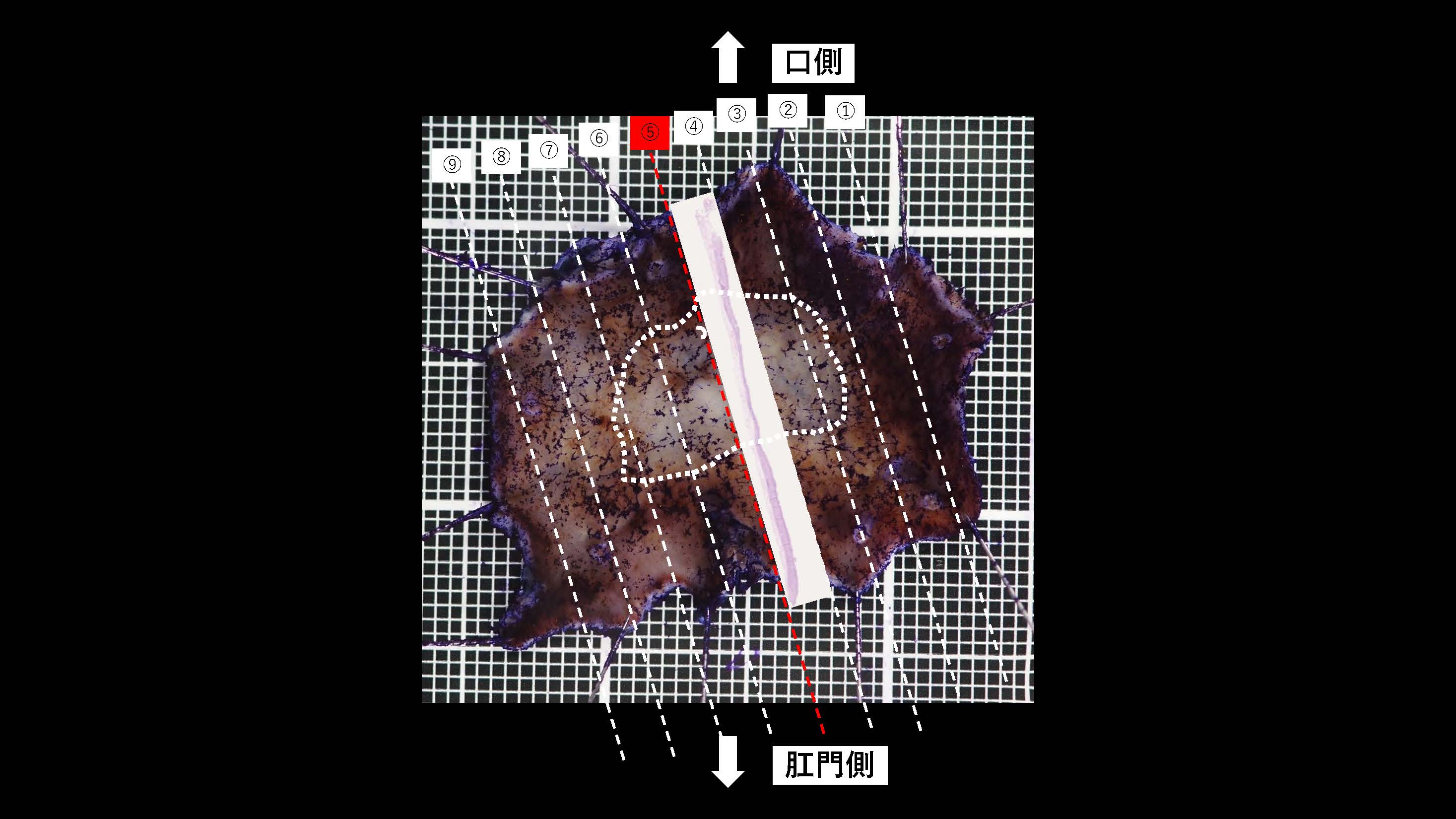 胃039